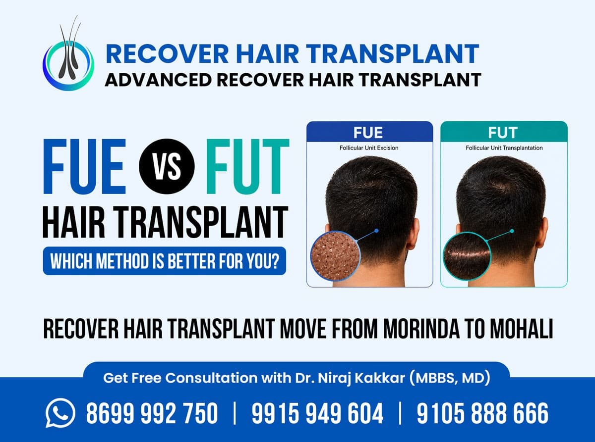 FUE Hair Transplant in Chandigarh