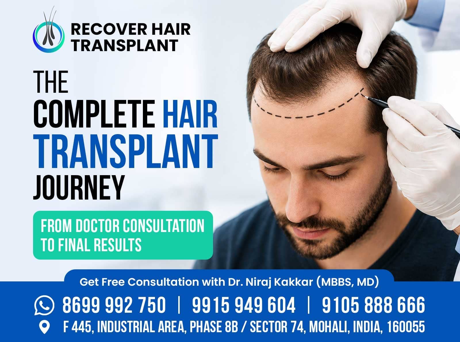 Hair Transplant Journey